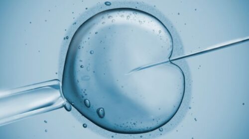 In-Vitro Fertilization