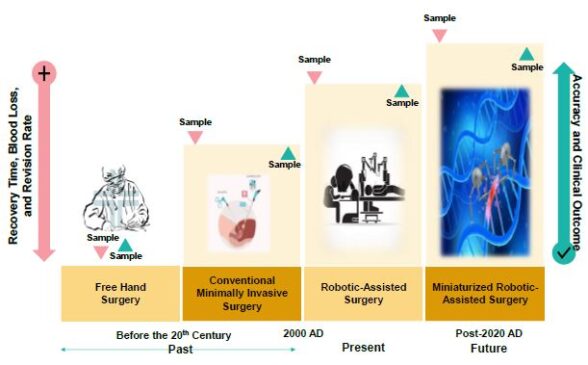 Minimally Invasive Surgery